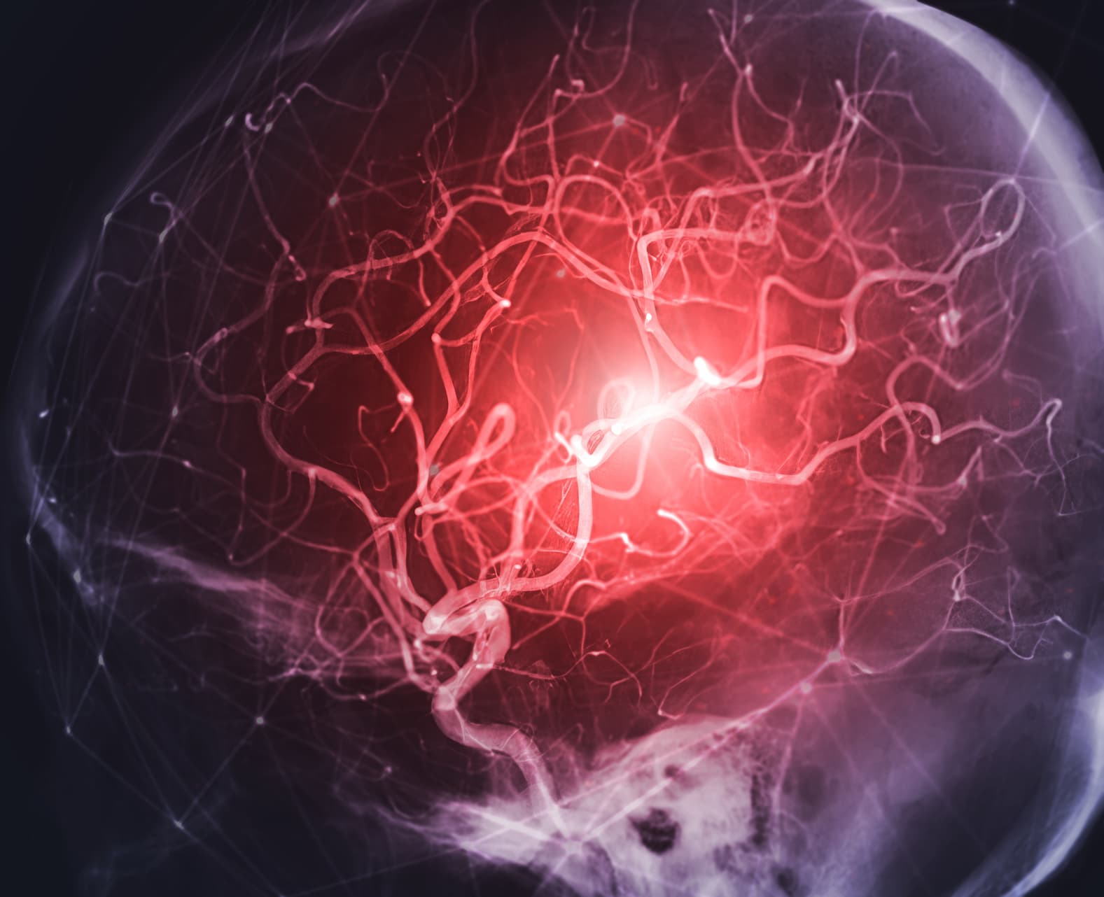 Graphic of the vascular route from bone marrow-derived stem cells through arterial access to the brain